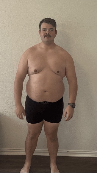 Antes